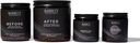 Ultimate Post Kirurgi Supplement Program - Før, Efter, Calmg, Arnica +