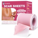 Silikone Scar Sheets, Silikone Scar Tape For Kirurgiske Scars, C- sektion, Tummy Tuck, Keloid Bump Fjernelse, Face Tape for Wrinkles Overnight (1.6 "X 59" Roll- 1,5 M -Pigment Reduction- Pink)