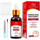 Toe Nail svamp behandlinger for Toenail: Nail svamp Behandling for Fingernegle - Ekstra styrke, Fast- Fungerende løsning til krakket, skadede, misfarvede negle