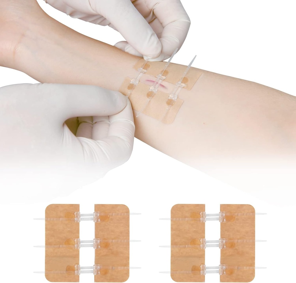 Zip Stitch laceration reparation uden Stitches Butterfly Bandaids Quick Clot - Emergency Wown Closies Device 2 Pieces