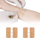 Zip Stitch laceration reparation uden Stitches Butterfly Bandaids Quick Clot - Emergency Wown Closies Device 2 Pieces