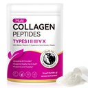 Multi Collagen Peptides Powder, 16 oz – Type I, II, III, V, X with Biotin, Hyaluronic Acid, Vitamin C, Unflavored Collagen Powder for Hair, Skin, Nails and Muscles, Easy Dissolve, Non-GMO