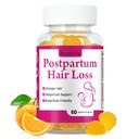 Aromlife Postpartum Hair Loss Gummies for Women Stronger Hair, Postpartum Hair Gummies with Biotin, Folate, Zine, Vitamin E, B6 & B12, 60 Count Vegan Breastfeeding-Friendly Postnatal Vitamins Gummy