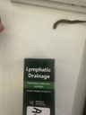 Lymphatic Drainage Drops - Herbal Lymph System Cleanse & Immune Support - Liquid with Echinacea, Elderberry, Ginger & Burdock Root - Vegan, Alcohol-Free, 1oz