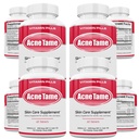 Acne piller Supplement- Clear Skin Vitaminer Pill til olieagtig hudbehandling, Hormonal Blemishes, Anti Spots & Cystic Acnes Kosttilskud til kvinder, mænd, Teens & Adults- 240 Oral tabletter