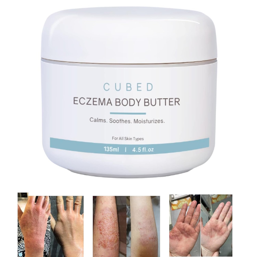 Cubured 4, 5 oz Eksem Cream til voksne, Eksem Relief, Eksem Behandling, Fugtgivende Dry Irridated Skin, Smart Lotion til topiske Steroid Abstinenssymptomer, Psoriasis & Rosacea, Eczema, Dermatitis