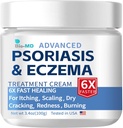 Bio - MD Psoriasis Eksem Cream, Eksem Cream til voksne, Ekstra styrke Kontrol Reaktion, Relieve Symptomer på resistent, Effektiv for Seborrheic Dermatitis, Folliculitis Behandling
