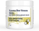Høj styrke Bee Venom Cream, Dyshidrotisk Eksem Salve, Heat Udslæt, Kløe, Eksem, Psoriasis, Ben, Mave, Foot, Hånd, Irriteret Hud, Al Alderspleje