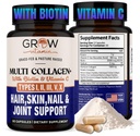 vokser vitamin Multi Collagen kapsler 1800MG (type I, II, III, V & X) - Ikke GMO, Grass Fed Collagen - Anti Aging Support til hår, hud, negle - Protein piller til fælles støtte - 90 Kapsler