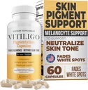 Dermaward Vitiligo kapsler (60 greve) Effektiv Vitiligo supplement, Reducere hvide skeder & forbedre hud pigmentering støtte, for alle hud & reducere hvide skeer på hud og tonet hud