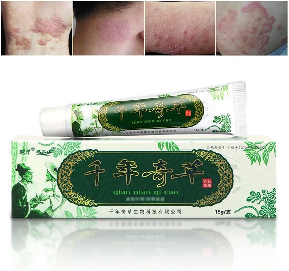 Oversøisk år- Herbal Cream Kinesisk Herbal Eczema, Psoriasis Creams Dermatitis og Eczema Pruritus Psoriasis JIULIN Salve