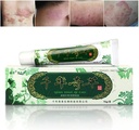 Oversøisk år- Herbal Cream Kinesisk Herbal Eczema, Psoriasis Creams Dermatitis og Eczema Pruritus Psoriasis JIULIN Salve