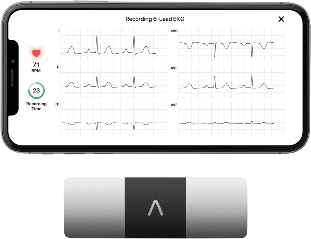 AliveCor KardiaMobile 6- Lead Personal EKG Monitor - Seks visninger af hjertet - Detects AFib og uregelmæssige arytmier - Instant Resultater i 30 sekunder - Arbejder med de fleste smartphones