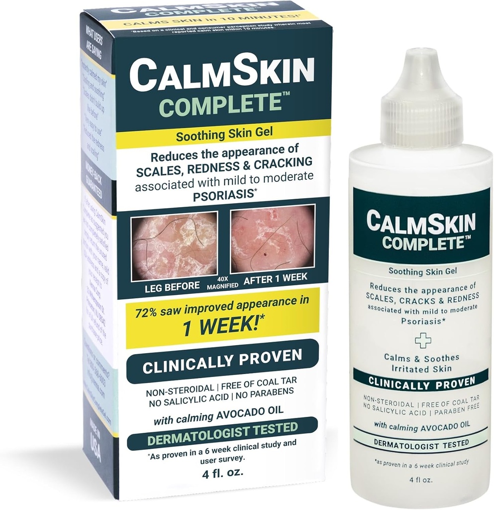 Xenna CalmSkin Komplet 124; Klinisk bevist til Sothe Irriteret Hud og forbedre Udseende af Hud med Mild til Moderate Psoriasis