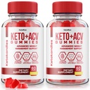 NutraRize (pakke med 2 KetoKandies Keto + ACV Gummies for vægttab, maksimal styrke supplement, Keto Kandies Anmeldelser (120 Gummies)