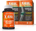 X Ray Dol Triple Action fælles supporttillæg med Glucosamin 1500mg, Chondroitin 800mg, MSM 750mg og 5X vitamin D for sunde joints, Bones & Cartiage - 60 greve per flaske - 2 Pack