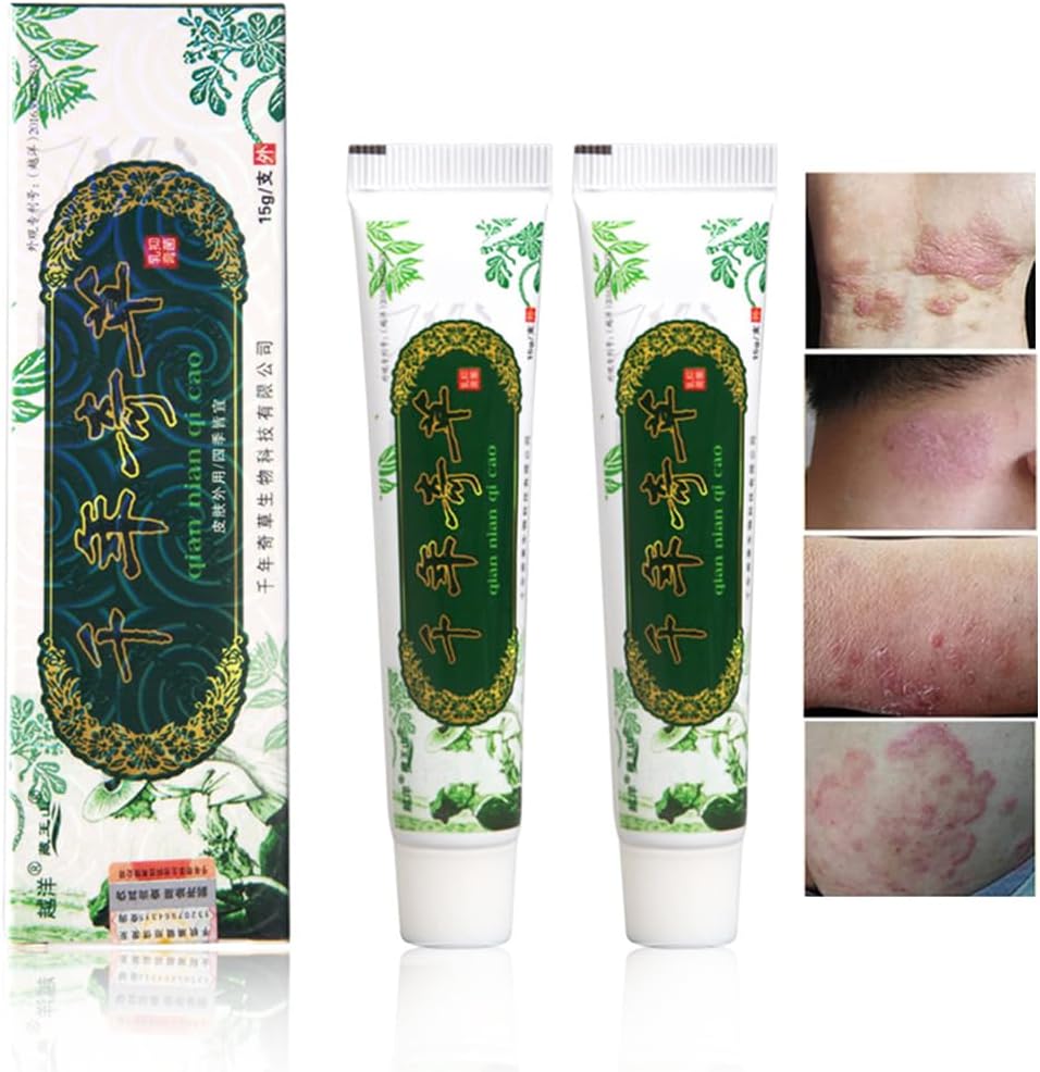 Oversøisk tusind år Herbal Cream Kinesisk Herbal Eczema, Psoriasis Creams Dermatitis og Eczema Psoriasis JIULIN Salve (2PCS)