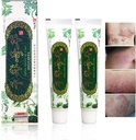 Oversøisk tusind år Herbal Cream Kinesisk Herbal Eczema, Psoriasis Creams Dermatitis og Eczema Psoriasis JIULIN Salve (2PCS)