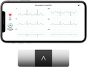 AliveCor KardiaMobile 6- Lead Personal EKG Monitor - Seks visninger af hjertet - Detects AFib og uregelmæssige arytmier - Instant Resultater i 30 sekunder - Arbejder med de fleste smartphones